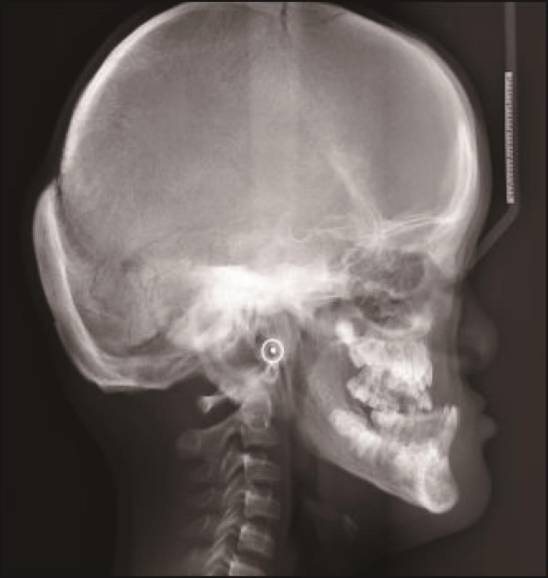 头颅X线摄影及其解剖 - 知乎