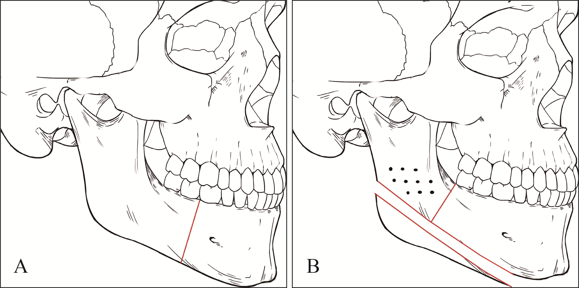55.颞下颌关节 (外面观)-系统解剖学-医学